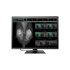EIZO RadiForce RX1270 Monitor PC 78,7 cm (31