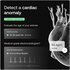Whitings Bilancia intelligente Body Scan con ECG 6 derivazioni, Composizione corporea segmentale, Peso, Età vascolare, Grasso viscerale, Rilevamento FA, Frequenza cardiaca, Salute dei nervi,IOS/Android White